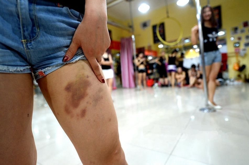 小孩子从小练舞蹈基本功,如劈腿、下腰等是否