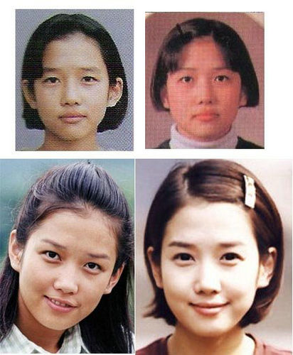 韩国女星整容前后对比照