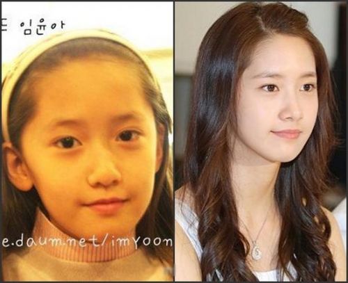 <em>少女时代林允儿</em>全智贤 揭韩国女星<em>整容</em>对比照