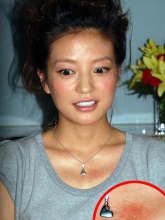 董卿脖子惊现杏红吻痕 曝女星的尴尬吻痕