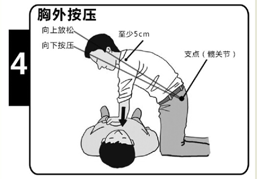 用竖笛吹欢乐颂谱子-第五步:打开气道.用仰头举颏法打开气道,使下颌角与耳垂连线垂直