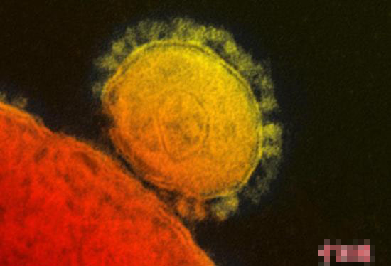 冠状病毒会传染人吗_狗狗冠状病毒怎么治疗_狗狗冠状病毒几天能好