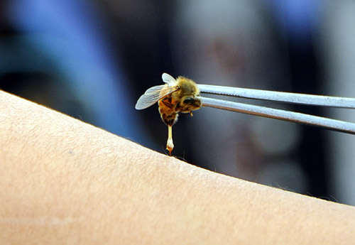 蜜蜂蛰人能抗癌?记者亲身体验“蜂疗” 结论不靠谱_新蓝网