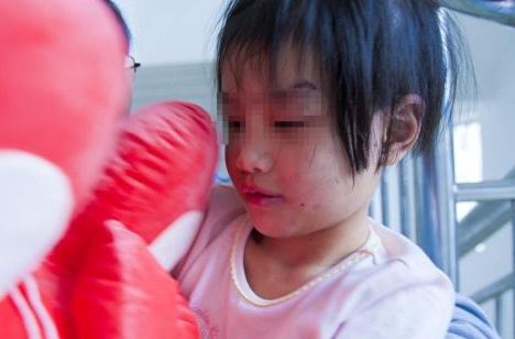 湖北<em>6岁女孩</em>身上有多处被咬伤痕迹 狠心后妈使