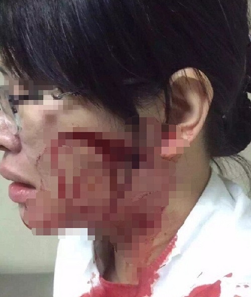 广州女护士被病人刺伤身中三刀 院方:无医患纠纷