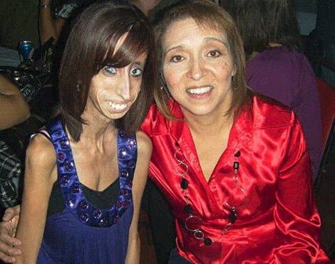 男子选丑大赛夺冠 看看世界最丑的男人