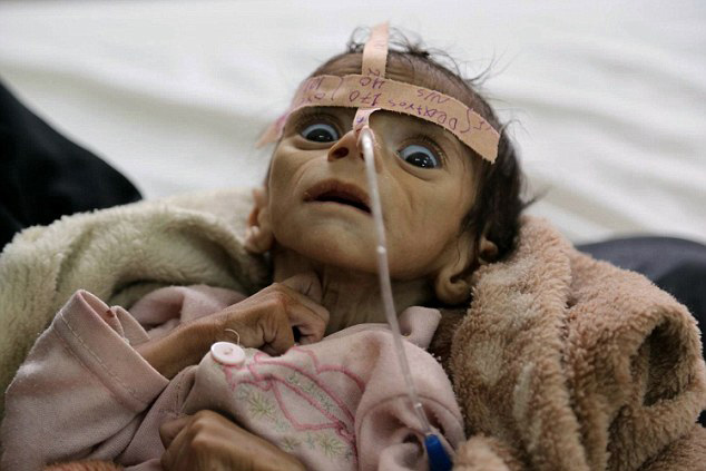 近日,一组五个月大的婴儿在战乱之地也门饿死的照片在网上曝光,令人