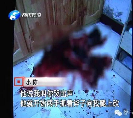 河南女子被丈夫砍16斧脚筋断裂 忍无可忍提离婚