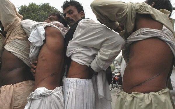 在印度，人体器官黑市交易分外火爆。（图片来源：美联社）