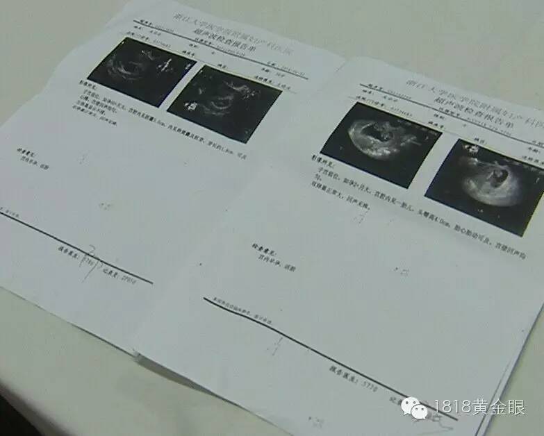 女子怀二胎被查出 疤痕妊娠 建议堕胎 她连工作