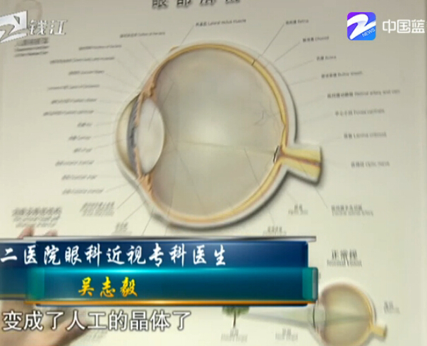 黑科技来了？此物一出再无近视眼 眼科医生如此说…
