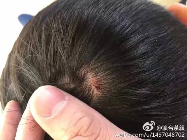丽江怎么了?因催菜生口角警察调解后离开 恐怖