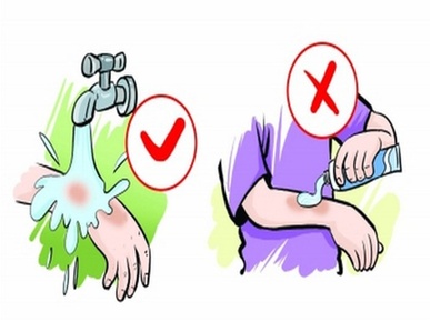 烫伤用牙膏涂抹不科学