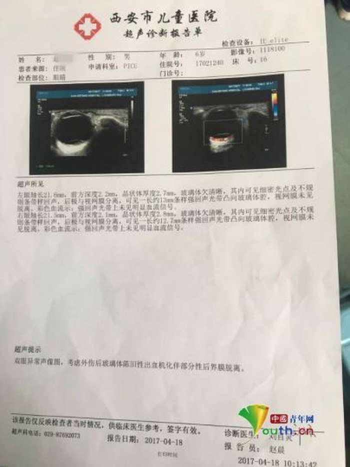 被虐待男童鹏鹏四月份医院超声诊断报告单.