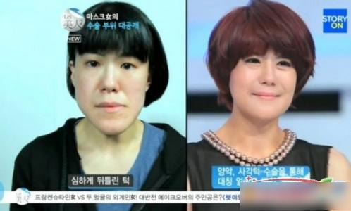 韩国双胞胎整形变美女脸 网友惊叹:太神了