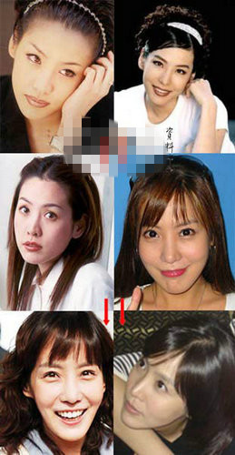 韩国女星整容成功典范图片
