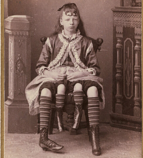 从十九世纪40年代到二十世纪70年代,畸形秀在美国的一些马戏团和