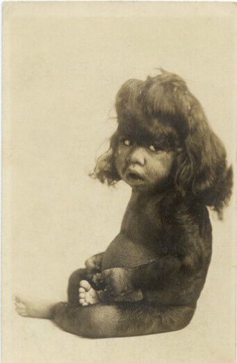 从十九世纪40年代到二十世纪70年代,畸形秀在美国的一些马戏团和