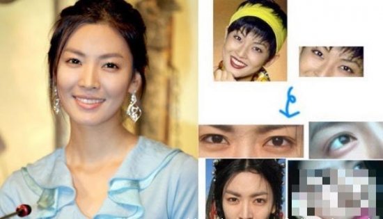 韩女星整容变脸对比照