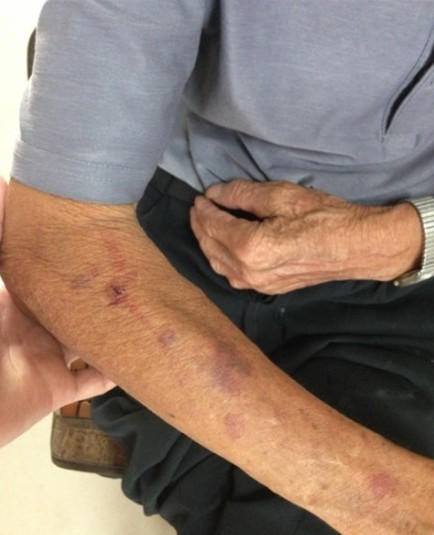 儿子逼八旬父母过户房子起冲突 致老父骨裂