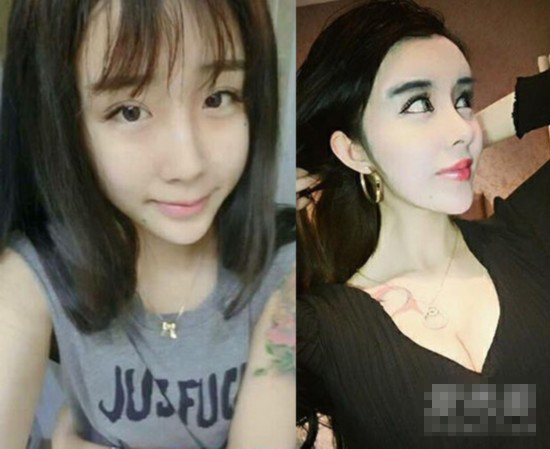 网络女整容失败反走红