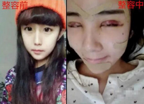 网络女整容失败反走红