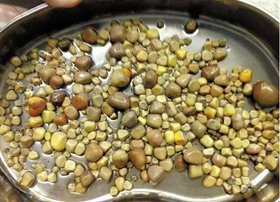 可怕!男子肾里长了420颗石头 因为他每天吃这道菜