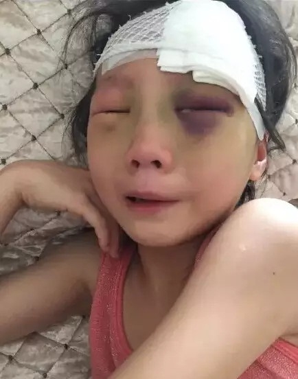 12岁男孩电梯内暴打8岁女童 他妈妈说的话让网友气炸了