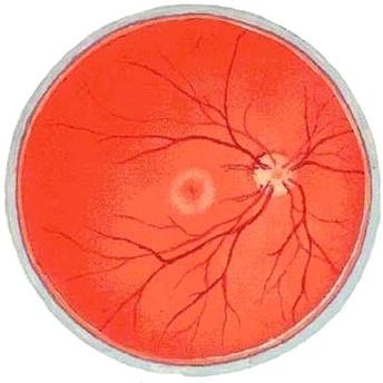 26岁女子做眼整右眼险失明 角膜被烧坏视力从1.0降到0.