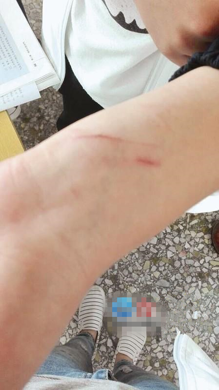 福建一醉酒男老师进宿舍打女生 被打女生:都不敢合上眼睛