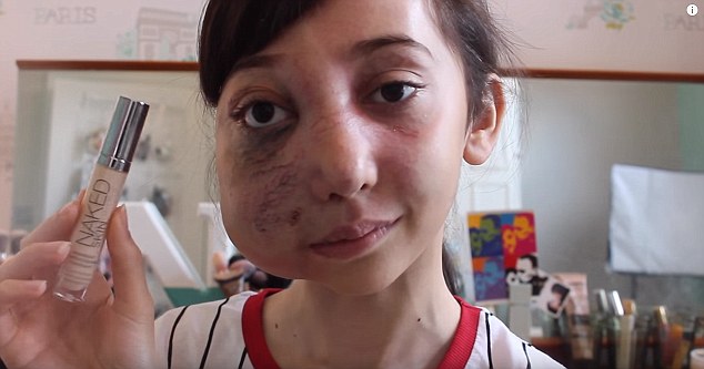 youtube11岁博主笑对疾病