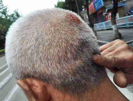 重庆一男子自己酒后摔破头 将血抹在引擎盖"碰瓷"女司机