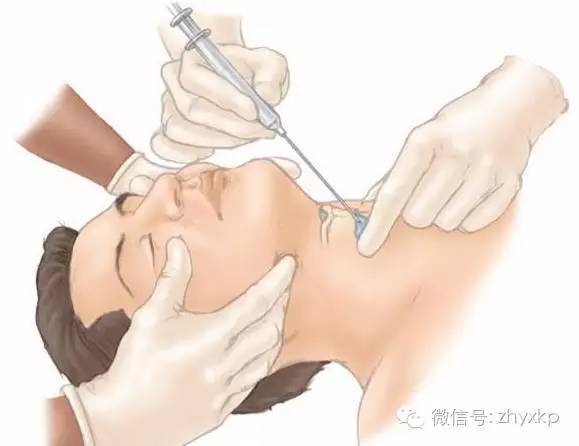 感冒乱吃过期药 皮疹憋气极凶险