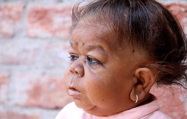 印度21岁男子体型如婴儿 被当地人当作神明转世