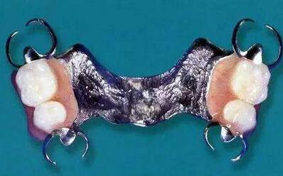 老太将带钩假牙吞肚里 医生竟在她嘴里塞了个安全套