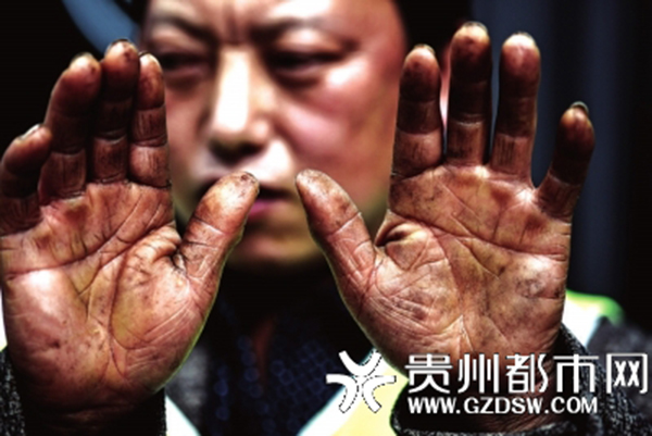 危险垃圾请勿随意丢弃:环卫工手被强酸腐蚀 有人手掌被割破