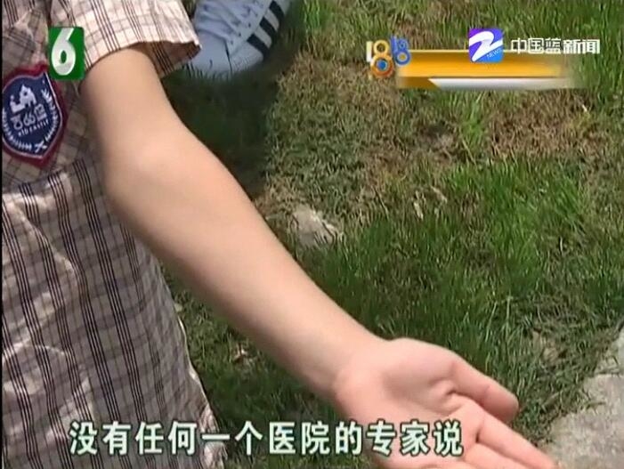 培训机构里摔了一跤女儿手臂现在越长越歪