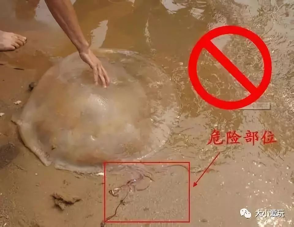 被海蜇蛰伤怎么办?