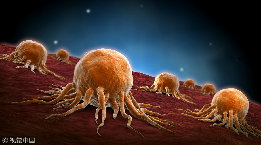 浙大一项研究找到肿瘤细胞生长"多米诺骨牌"