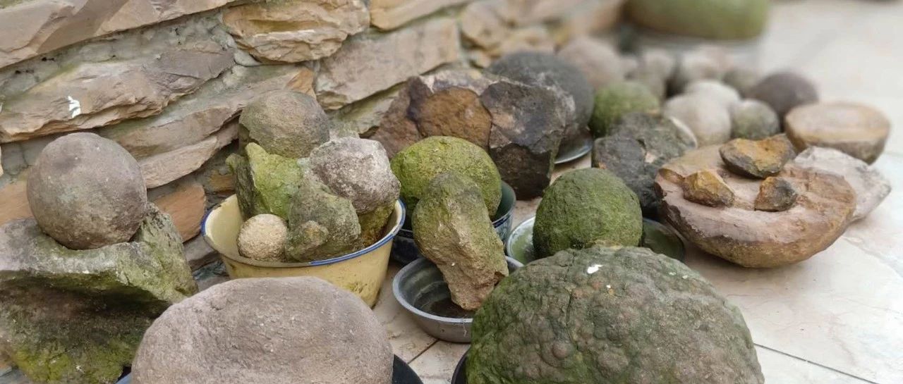 无名指骨折 钉一枚纽扣来固定!